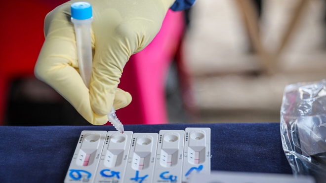 A Brazzaville, le recours aux tests de diagnostic antigénique rapide est en augmentation