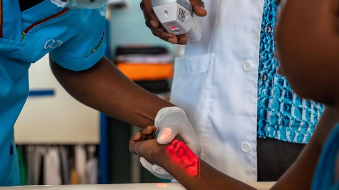 Le Sénégal a augmenté ses capacités de diagnostic précoce du cancer de l'enfant