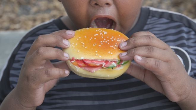 En Afrique, beaucoup d'enfants sont en surpoids 