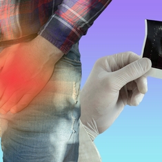 L'adénome de la prostate, un grossissement lié à l'âge