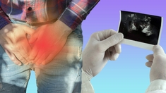 L'adénome de la prostate, un grossissement lié à l'âge