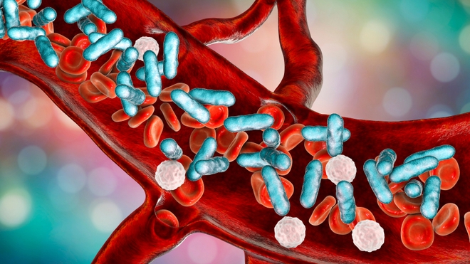 Illustration en 3D du sepsis