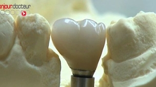 Prothèses dentaires : origines à contrôler
