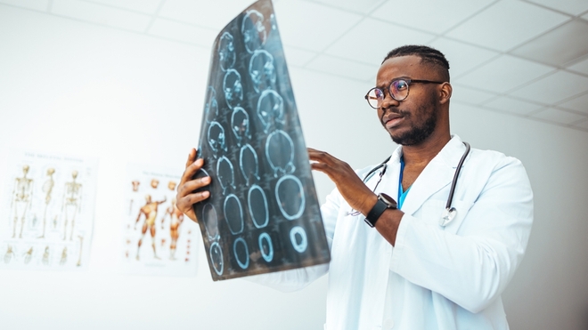 L'IRM cérébrale reste un examen de référence pour diagnostiquer un accident vasculaire cérébral