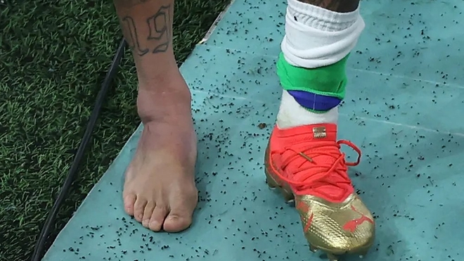 Neymar souffre d'une entorse à la cheville 