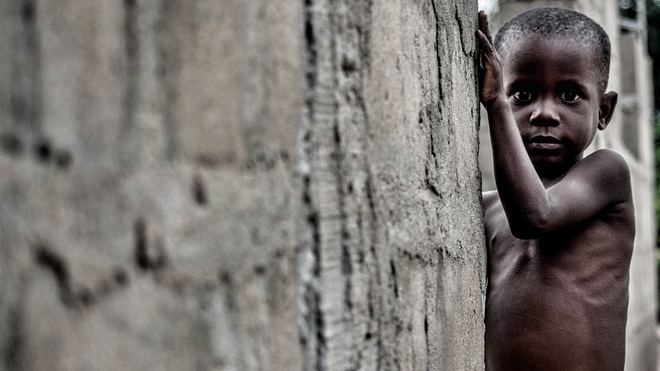 De nombreux enfants souffrent de malnutrition