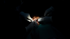 La santé bucco-dentaire, la grande oubliée en Afrique