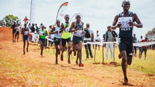 Insuffisance veineuse : causes, symptômes, sport... tout savoir sur la varice 