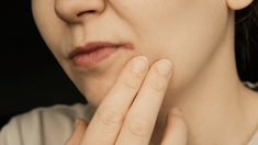 Commissures des lèvres fendues : tout savoir sur la perlèche