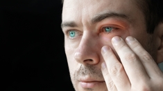 On vous explique comment reconnaître et soigner une conjonctivite