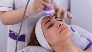 La radiofréquence est-elle vraiment efficace contre les rides ?