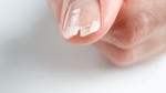 Mes ongles se cassent : quelles solutions ? 