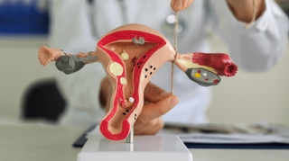 Ligature, salpingectomie... tout savoir sur la contraception définitive chez les femmes