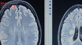 Une IRM du cerveau pour diagnostiquer un comportement pédophile ?