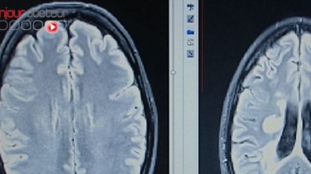 Une IRM du cerveau pour diagnostiquer un comportement pédophile ?