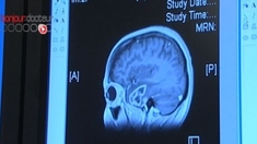 La chanteuse Sheryl Crowe souffre d'une tumeur bénigne au cerveau