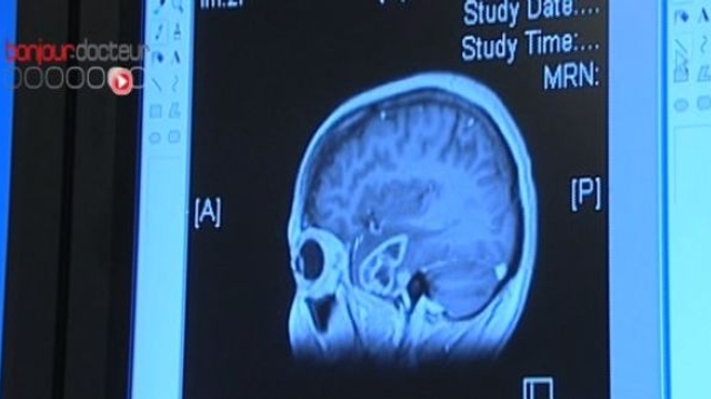 La chanteuse Sheryl Crowe souffre d'une tumeur bénigne au cerveau