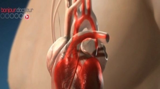 Crises cardiaques : moins de décès, mais plus de femmes touchées