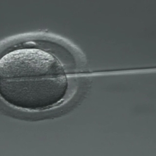 Tout savoir sur la fécondation in vitro