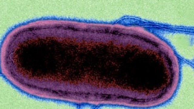 Une salmonellose mortelle se développe en Afrique subsaharienne