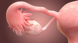 Kystes des ovaires : c'est grave docteur ?