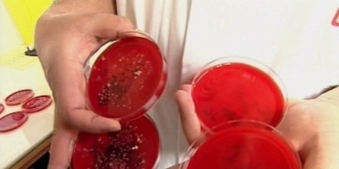 Dans ces boites de Petri, quatre des onze souches bactériennes identifées par les chercheurs comme susceptibles d'influencer nos opinions.