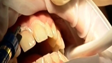 Ch@t : La santé de vos dents