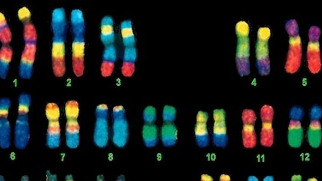 Myopathie de Landouzy-Dejerine : tous les gènes responsables enfin identifiés