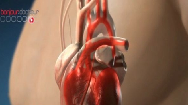 Insuffisance cardiaque aiguë : la glycémie, un indicateur ?