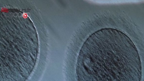 Endométriose : à quelles conditions les femmes peuvent-elles faire congeler leurs ovocytes ?