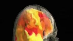 Le désir sexuel au coeur du cerveau