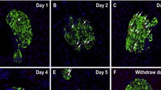 Diabète : une hormone pour régénérer les cellules productrices d'insuline ?