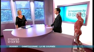 Camptocormie : la maladie du dos courbé