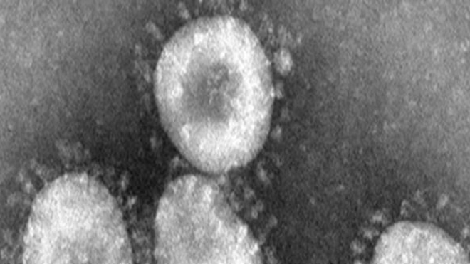 Le virus MERS fait partie de la famille des coronavirus, comme le SRAS 
