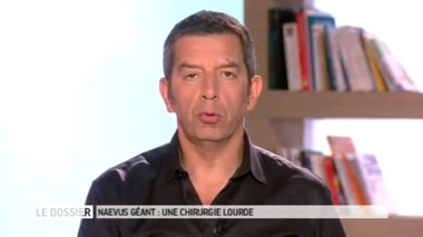 Naevi géants : des grains de beauté imposants