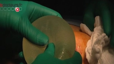 TÜV, certificateur des prothèses PIP, versera 60 millions d'euros aux victimes