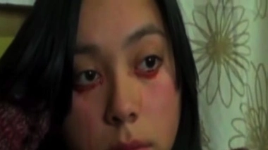 Insolite : elle pleure des larmes… de sang !