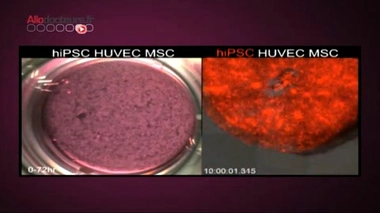 Reportage de Claire Ricard et Dominique Tchimbakala.