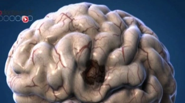 Article du 1er février 2017, mis à jour le 8 février 2017.