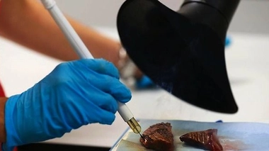 Le bistouri du futur reconnaît les tumeurs