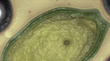 ©Chantal Abergel/Jean-Michel Claverie