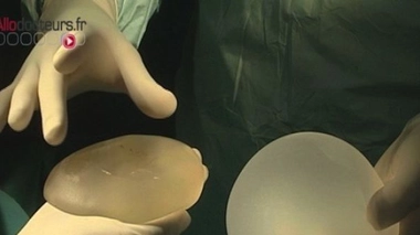 Prothèses PIP : 41 millions d'euros de dommages et intérêts en Argentine