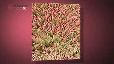 Fusobacterium nucleatum, une bactérie qui pourrait être impliquée dans le cancer du côlon