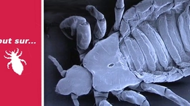 Le pou, ce parasite qui nous résiste !