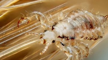 Lutte contre les poux : les idées reçues !