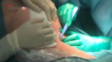 Cancer du sein : la radiothérapie durant l'opération, un traitement en un jour