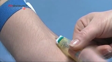 Près de 20% des Français en excès de cholestérol