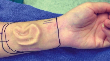 L'image de la semaine : les bras ont des oreilles...