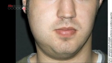 Les oreillons sont de retour...