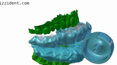 Un dentier amovible qui brosse les dents en 6 secondes !
